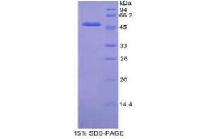 SDS-PAGE analysis of Mouse KIF5A Protein. (KIF5A 蛋白)