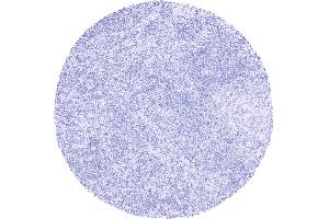 PAX8 staining is completely absent in lymphocytes lymph node (Recombinant PAX8 抗体)
