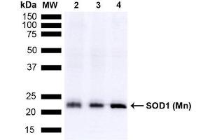 Western blot analysis of Mouse Brain, Rat Brain, and Rat Brain Membrane showing detection of 24. (SOD2 抗体  (Biotin))