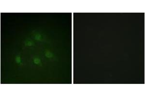Immunofluorescence analysis of HeLa cells, using Smad1 (Ab-187) Antibody. (SMAD1 抗体  (AA 153-202))