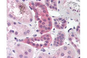Anti-RPAIN antibody IHC of human kidney. (RPAIN 抗体  (C-Term))