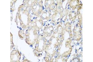 Immunohistochemistry of paraffin-embedded Human stomach using AHCYL1 Polyclonal Antibody at dilution of 1:100 (40x lens). (AHCYL1 抗体)