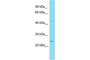 Host: Rabbit Target Name: WFDC3 Sample Type: 721_B Whole Cell lysates Antibody Dilution: 1. (WFDC3 抗体  (N-Term))