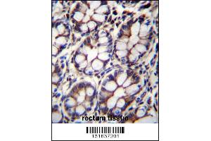 IQCA1 Antibody immunohistochemistry analysis in formalin fixed and paraffin embedded human rectum tissue followed by peroxidase conjugation of the secondary antibody and DAB staining. (IQCA1 抗体  (C-Term))