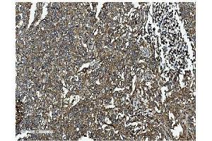 IHC analysis of Clathrin heavy chain/CLTC using anti-Clathrin heavy chain/CLTC antibody (ABIN7602704). (Clathrin Heavy Chain (CLTC) (AA 967-1668) 抗体)