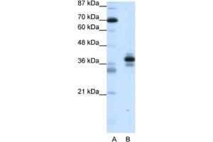 Western Blotting (WB) image for anti-Paired-Like Homeodomain 1 (PITX1) antibody (ABIN2461668) (PITX1 抗体)