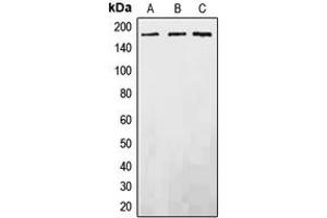 Western blot analysis of EGFR expression in DLD (A), SP2/0 (B), PC12 (C) whole cell lysates. (EGFR 抗体  (C-Term))