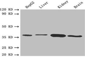 Western blot All lanes: BDH1 antibody at 2. (BDH1 抗体  (AA 47-343))