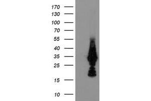 Western Blotting (WB) image for anti-Methylmalonic Aciduria (Cobalamin Deficiency) CblC Type, with Homocystinuria (MMACHC) antibody (ABIN1499513) (MMACHC 抗体)