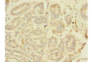 Immunohistochemistry (IHC) image for anti-T-Cell Activation rho GTPase-Activating Protein (TAGAP) (AA 97-260) antibody (ABIN7171326)