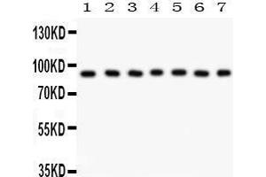 Western Blotting (WB) image for anti-Ribosomal Protein S6 Kinase, 90kDa, Polypeptide 5 (RPS6KA5) (AA 540-665) antibody (ABIN3043424)