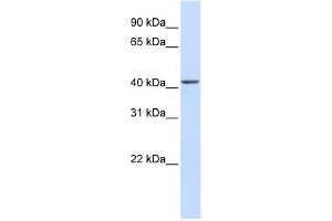 NOB1 antibody used at 1 ug/ml to detect target protein. (NOB1 抗体)