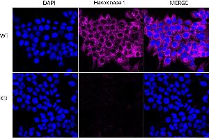 Immunocytochemical staining of HeLa cells using Hexokinase 1 antibody (ABIN7798906), 1:1,000), Top panel: wild-type (WT), Bottom panal: Hexokinase 1 shRNA knockdown (KD). (Recombinant Hexokinase 1 抗体)