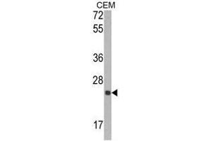 Western blot analysis of TIMP1 Antibody (N-term) in CEM cell line lysates (35ug/lane). (TIMP1 抗体  (N-Term))