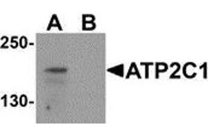 Western blot analysis of ATP2C1 in mouse brain tissue lysate with ATP2C1 antibody at 1 μg/ml in (A) the absence and (B) the presence of blocking peptide (ATP2C1 抗体  (C-Term))