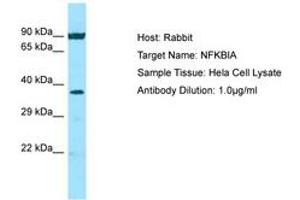 Image no. 1 for anti-Nuclear Factor of kappa Light Polypeptide Gene Enhancer in B-Cells Inhibitor, alpha (NFKBIA) (N-Term) antibody (ABIN6749808) (NFKBIA 抗体  (N-Term))
