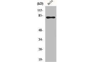 Western Blot analysis of HeLa cells using Phospho-Rad17 (S645) Polyclonal Antibody (RAD17 抗体  (pSer645))