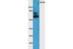 Western Blotting (WB) image for anti-Solute Carrier Family 18 (Vesicular Acetylcholine), Member 3 (SLC18A3) (AA 201-300) antibody (ABIN735113)