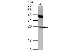WB Image Sample (30 ug of whole cell lysate) A: A431 , 12% SDS PAGE antibody diluted at 1:1000 (IFNA2 抗体  (C-Term))