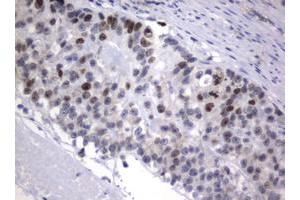 Image no. 5 for anti-Antigen Identified By Monoclonal Antibody Ki-67 (MKI67) (AA 1160-1493) antibody (ABIN1490860)