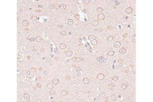 Immunohistochemistry of paraffin-embedded Mouse brain using ABCF2 Polyclonal Antibody at dilution of 1:100 (40x lens). (ABCF2 抗体)