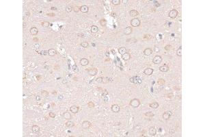 Immunohistochemistry of paraffin-embedded Mouse brain using ABCF2 Polyclonal Antibody at dilution of 1:100 (40x lens).