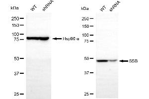 Western blotting analysis using SSB antibody (ABIN7800357). (SSB 抗体)