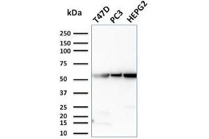 Western Blot Analysis of T47D, PC3, HePG2 cell lysates using GPI Mouse Monoclonal Antibody (CPTC-GPI-1).