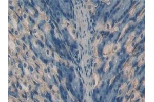 Immunohistochemistry (IHC) image for anti-Tumor Necrosis Factor (Ligand) Superfamily, Member 11 (TNFSF11) (AA 92-263) antibody (ABIN7432754)