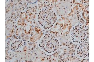 ABIN6268991 at 1/200 staining human kidney tissue sections by IHC-P.