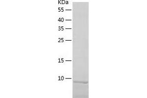 Western Blotting (WB) image for LSM5 Homolog, U6 Small Nuclear RNA Associated (LSM5) (AA 1-91) protein (His tag) (ABIN7123796) (LSM5 Protein (AA 1-91) (His tag))