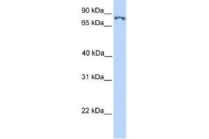 WB Suggested Anti-SSRP1 Antibody Titration:  0. (SSRP1 抗体  (N-Term))