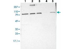 Western blot analysis of Lane 1: RT-4, Lane 2: EFO-21, Lane 3: A-431, Lane 4: Liver, Lane 5: Tonsil with ELFN2 polyclonal antibody  at 1:250-1:500 dilution. (ELFN2 抗体)