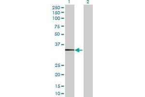 Western Blot analysis of TBC1D21 expression in transfected 293T cell line by TBC1D21 MaxPab polyclonal antibody. (TBC1D21 抗体  (AA 1-336))