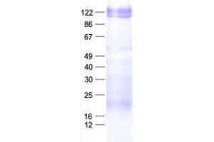 Western Blotting (WB) image for Zinc Finger Protein 274 (ZNF274) protein (His tag) (ABIN2735979)