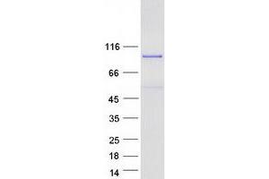 Western Blotting (WB) image for Mediator Complex Subunit 25 (MED25) protein (Myc-DYKDDDDK Tag) (ABIN2725756)