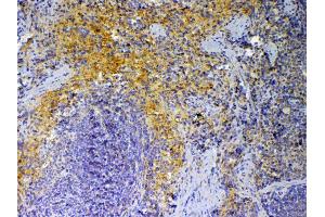 IHC analysis of PF4 using anti-PF4 antibody .