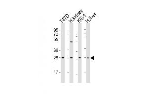 All lanes : Anti-HAVCR2 Antibody (Center) at 1:2000 dilution Lane 1: T47D whole cell lysates Lane 2: human kidney lysates Lane 3: KG-1 whole cell lysates Lane 4: human liver lysates Lysates/proteins at 20 μg per lane. (TIM3 抗体  (AA 167-194))