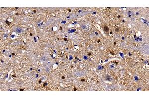 Immunohistochemistry (IHC) image for anti-S100 Calcium Binding Protein B (S100B) (AA 1-92) antibody (ABIN7432076)