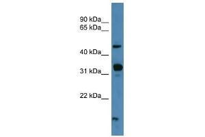 NPFFR2 antibody used at 0. (NPFFR2 抗体  (C-Term))