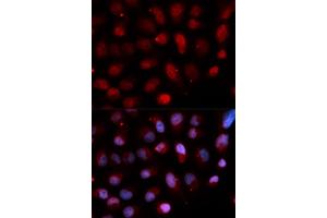 Immunofluorescence analysis of U2OS cells using ETV4 antibody. (ETV4 抗体)