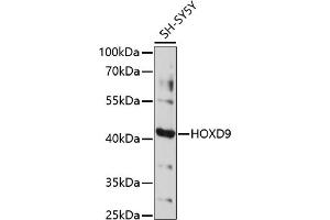 Western blot analysis of extracts of SH-SY5Y cells, using HOXD9 antibody (ABIN7267776) at 1:1000 dilution. (HOXD9 抗体  (AA 100-200))