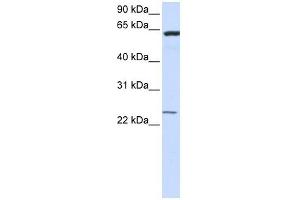 TMEM138 antibody used at 1 ug/ml to detect target protein. (TMEM138 抗体  (N-Term))