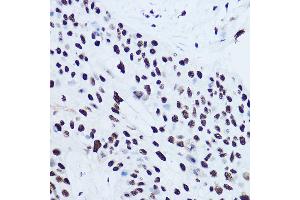 Immunohistochemistry (IHC) image for anti-Sjogren Syndrome Antigen B (SSB) (AA 166-408) antibody (ABIN3015265)