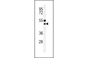 CD1E Antibody (Center) (ABIN653900 and ABIN2843142) western blot analysis in MDA-M cell line lysates (35 μg/lane). (CD1e 抗体  (AA 184-212))