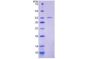 SDS-PAGE analysis of Mouse POLa1 Protein.