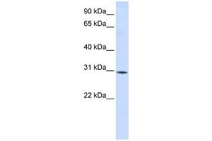 WB Suggested Anti-RBM7 Antibody Titration:  0. (RBM7 抗体  (Middle Region))