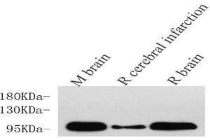 Western Blot analysis of various samples using DLG4 Polyclonal Antibody at dilution of 1:750. (DLG4 抗体)