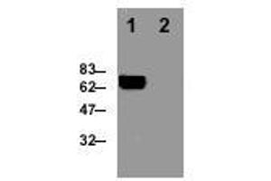 Image no. 1 for anti-Perforin 1 (Pore Forming Protein) (PRF1) antibody (ABIN187561) (Perforin 1 抗体)