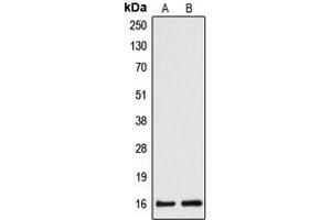 Western blot analysis of Cytochrome b5A expression in HepG2 (A), HeLa (B) whole cell lysates. (CYB5A 抗体  (Center))